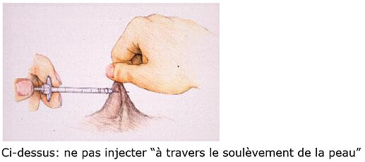 injection non correcte